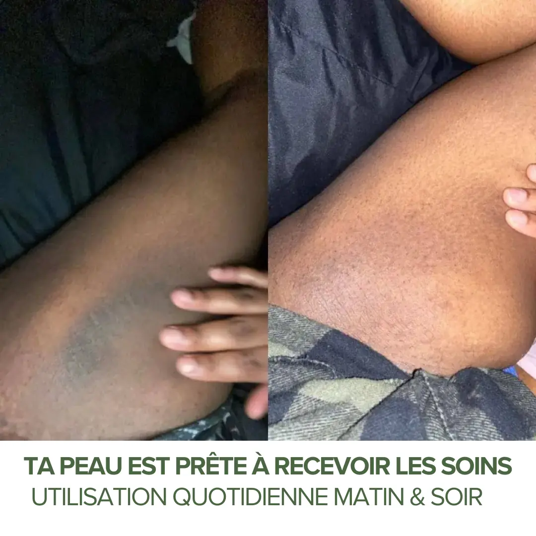Notre savon vs les autres