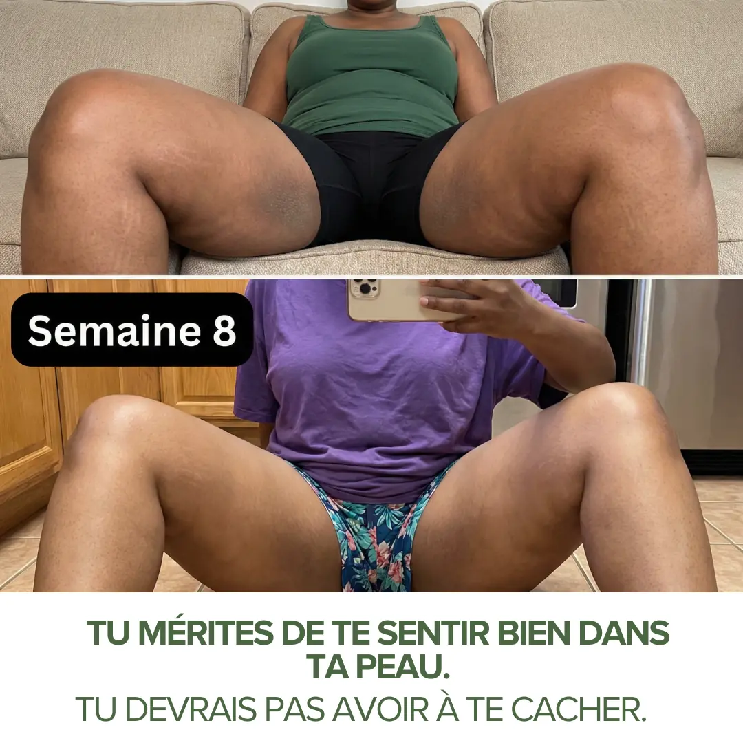 Progression des resultats avec le savon